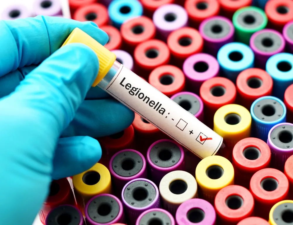 A sample tube containing water with Legionella present.